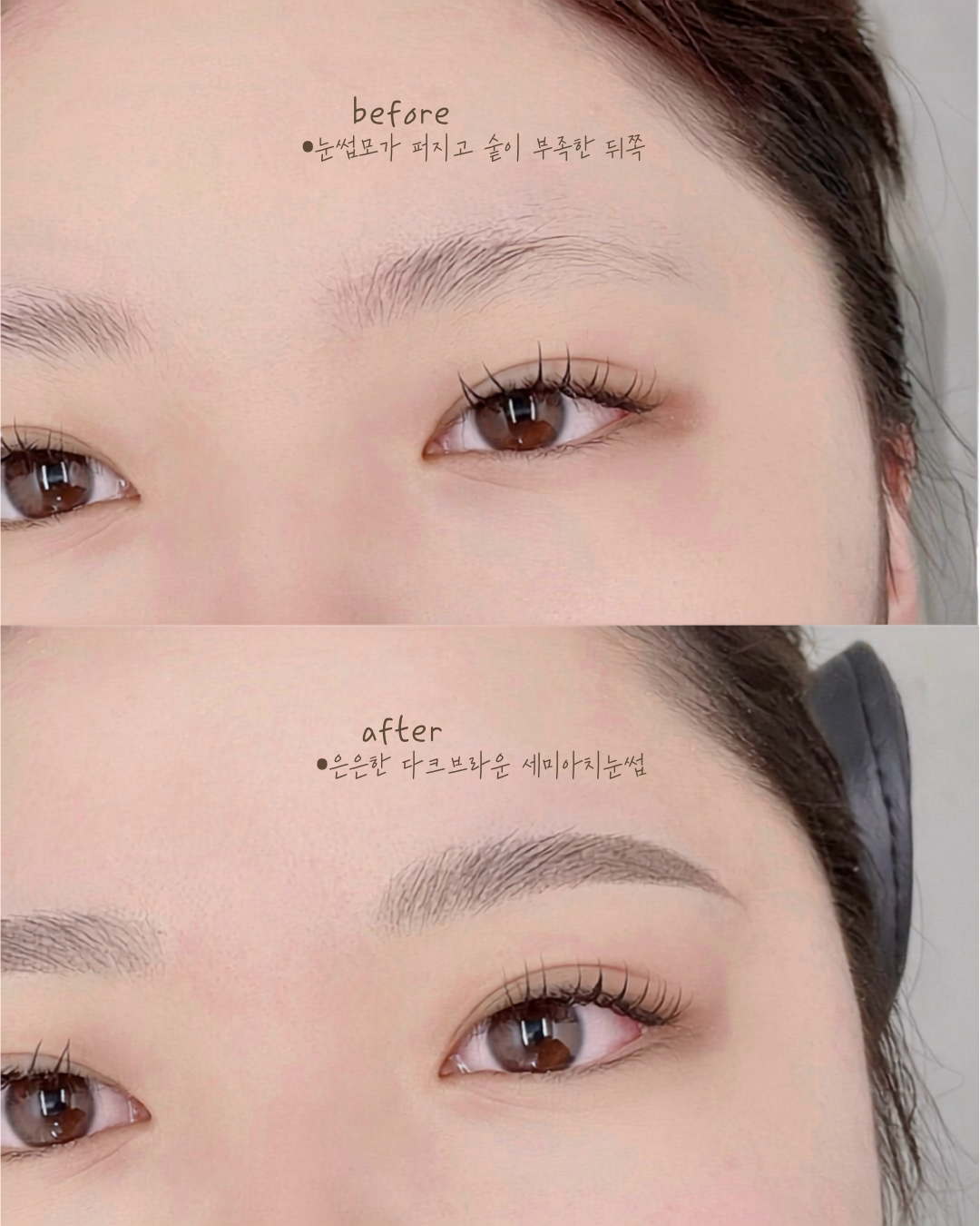 콤보눈썹 시술 전후 비교 사진